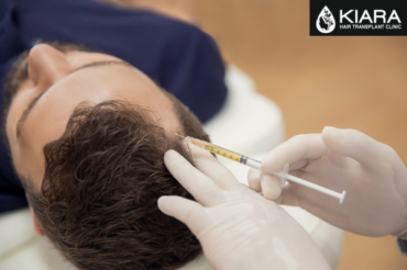 Exploring PRP Hair Treatment at Chandigarh