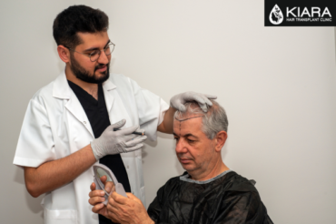 NeoGraft Hair Transplant Clinic In Chandigarh