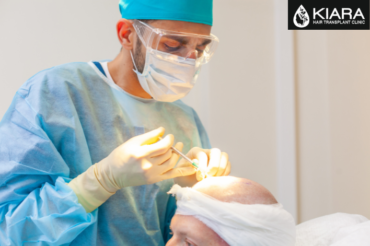 Essential Tips for Choosing a Hair Transplant Clinic in Chandigarh